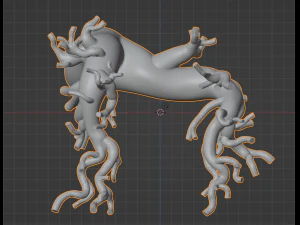 Pulmonary arteries 3D Model