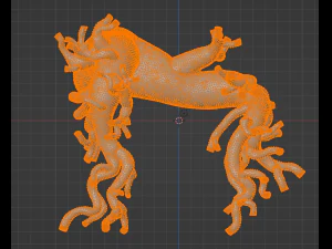 Pulmonary arteries 3D Model
