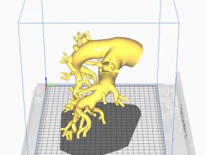 Pulmonary arteries 3D Model