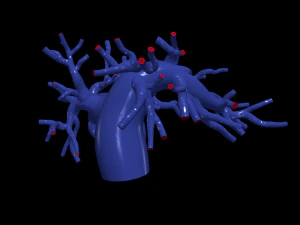 Pulmonary arteries 3D Model