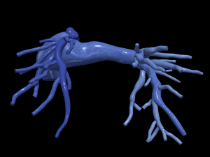 Pulmonary arteries 3D 모델