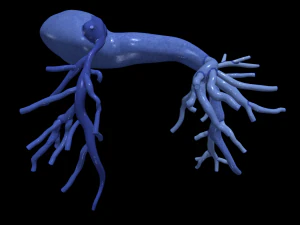 Pulmonary arteries 3D Model