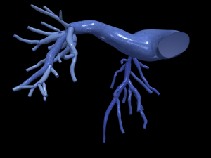 Pulmonary arteries 3D 모델
