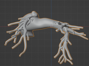 Pulmonary arteries 3D 모델