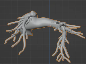Pulmonary arteries 3D Model