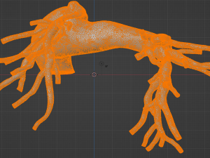 Pulmonary arteries 3D 모델