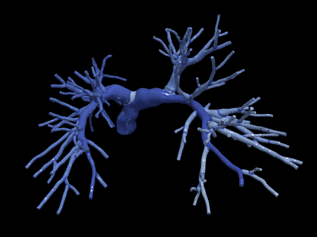 Pulmonary arteries 3D Model .c4d .max .obj .3ds .fbx .stl .blend 