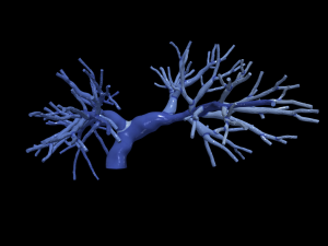 Pulmonary arteries 3D Model