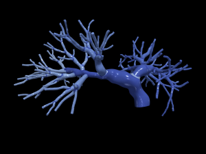 Pulmonary arteries 3D Model