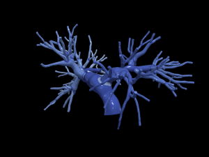 Pulmonary arteries 3D Model