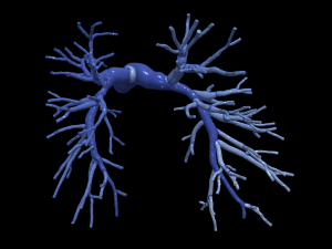 Pulmonary arteries 3D Model