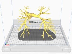 Pulmonary arteries 3D Model