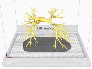 Pulmonary arteries 3D Model