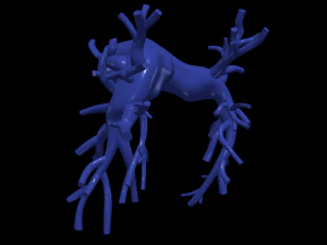 Pulmonary arteries 3D Model