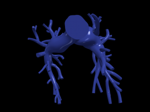 Pulmonary arteries 3D Модель