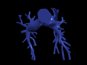 Pulmonary arteries 3D Model