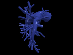 Pulmonary arteries 3D Model