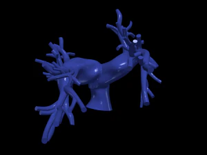 Pulmonary arteries 3D Model