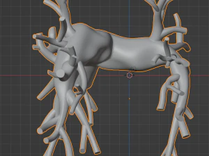 Pulmonary arteries 3D Model