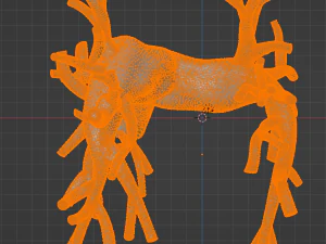 Pulmonary arteries 3D Model