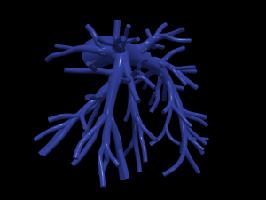 Pulmonary arteries 3D Model