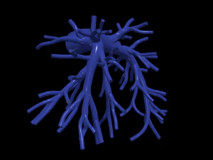 Pulmonary arteries 3D Model