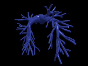 Pulmonary arteries 3D Model