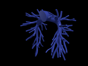 Pulmonary arteries 3D Model