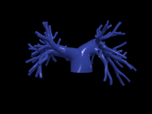 Pulmonary arteries 3D Model