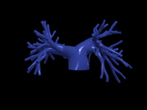 Pulmonary arteries 3D Model