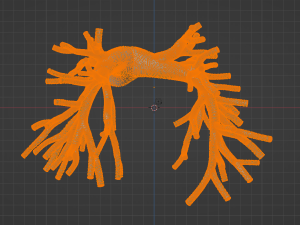 Pulmonary arteries 3D Model