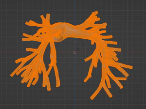 Pulmonary arteries 3D Model