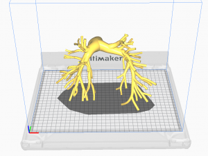 Pulmonary arteries 3D Model