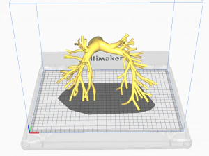 Pulmonary arteries 3D Model