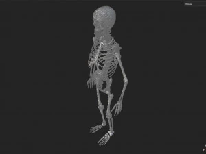Surgical Skeleton 3D Model