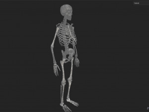 Surgical Skeleton 3D Model