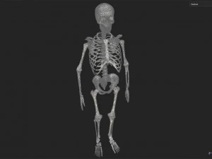 Surgical Skeleton 3D Model