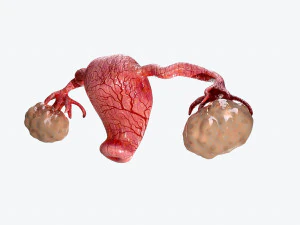 rahim ve yumurtalıklar d&uuml;ş&uuml;k poli 3D Model