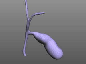 Gallbladder 3D Модель