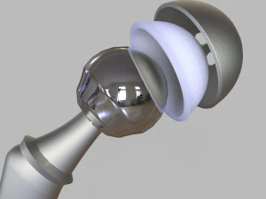 Substitui&ccedil;&atilde;o de quadril Modelo 3D