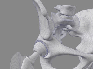 Hip Replacement 3D Model
