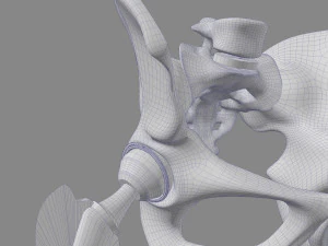 Substitui&ccedil;&atilde;o de quadril Modelo 3D