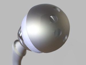 Hip Replacement 3D Model