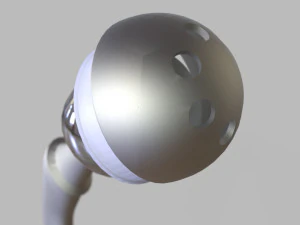 Substitui&ccedil;&atilde;o de quadril Modelo 3D