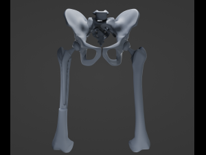 Hip Replacement 3D Model