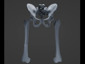 Substitui&ccedil;&atilde;o de quadril Modelo 3D