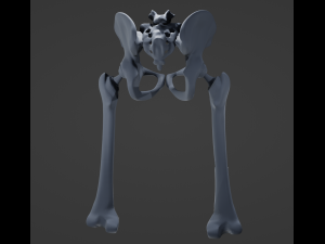 Hip Replacement 3D Model