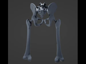 Substitui&ccedil;&atilde;o de quadril Modelo 3D
