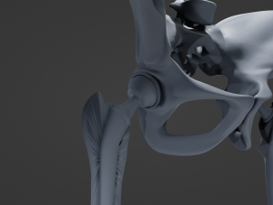 Hip Replacement 3D Model