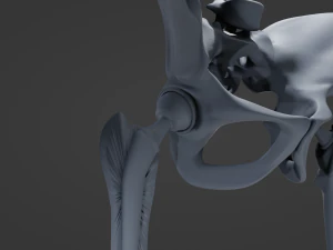 Substitui&ccedil;&atilde;o de quadril Modelo 3D
